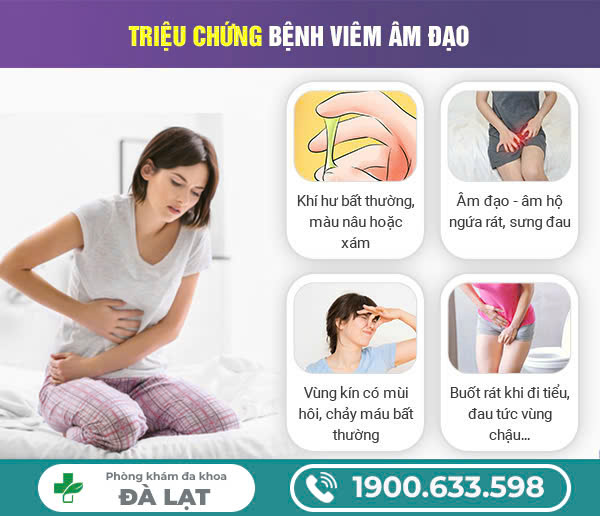 Hình ảnh minh họa